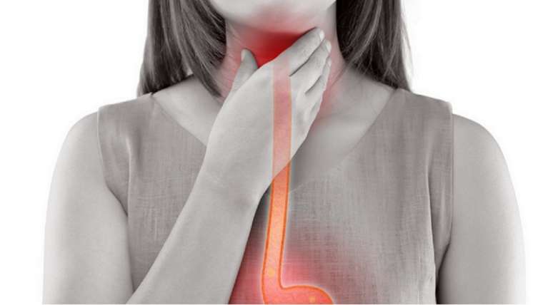 Refluxul gastroesofagian – solutii pentru ameliorarea simptomelor